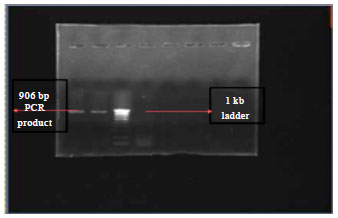 Image for - Characterization, Comparison Study of Outer Membrane Protein OMPL1 of Pathogenic Leptospira Species for Disease Diagnosis