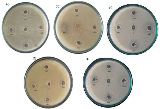 Image for - Isolation and Identification of Antimicrobial Protein from Saccharomyces cerevisiae and its Efficacy Against the Human Pathogens