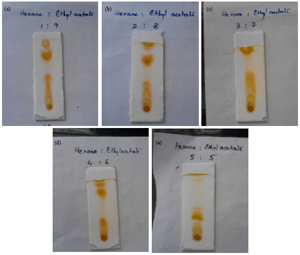 Image for - Evaluation of Biological Activity of Secondary Metabolites of Neurospora crassa from Machilipatnam Sea Water