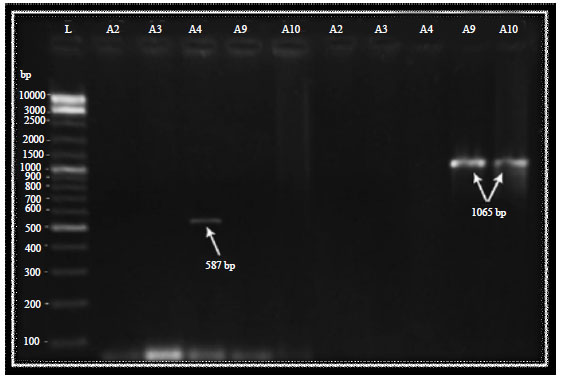 Image for - First Report of the blaOXA-23 Gene in a Clinical Isolates of Acinetobacter baumannii in Najaf Hospitals-Iraq