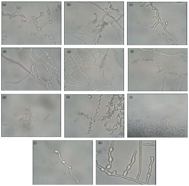 Image for - Taxonomic Diversity and Antimicrobial Activities of Actinomycetes from Manure Composts