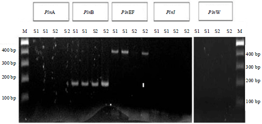 Image for - In Silico Analysis of Plantaricin EF that Expressed by Plasmid-Associated Bacteriocin Production Gene of Lactobacillus plantarum IBL-2 for Anti-Candida Agent Potential