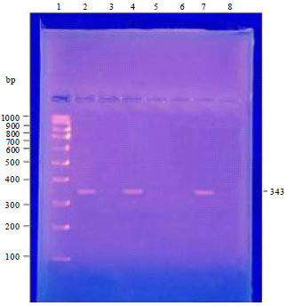Image for - Application of Specific Media, API Technique and PCR for Rapid Confirmation of Listeria monocytogenes in Foodstuffs and Water