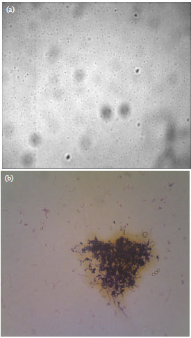 Image for - Encapsulation of Lactobacillus acidophilus FNCC 0051 in Hydrogel Using a Complex Coacervation of Glucomannan and Chitosan