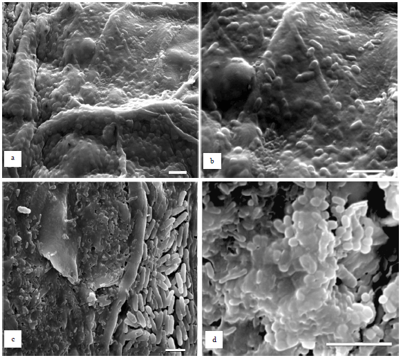Image for - Characterization of Microorganisms from Fresh Produce in Alberta, Canada Reveals Novel Food-spoilage Fungi