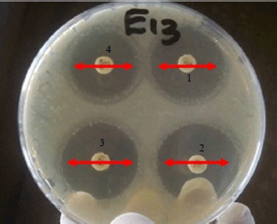 Image for - Molecular Identification of MBL Genes blaIMP-1 and blaVIM-1 in Escherichia coli  Strains Isolated from Abattoir by Multiplex PCR Technique