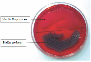 Image for - Methods of Determination of Biofilm Formation by Candida albicans