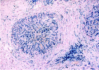 Image for - Assessing the Haematological/Chemical Pathological Properties of a Polyherbal Formulation on Liver Fibrosis
