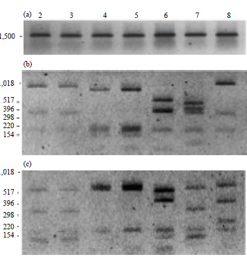 Image for - Identification of HACEK Group Bacteria from Blood Samples of Patients with Infective Endocarditis by PCR-RFLP of the 16s rRNA Gene