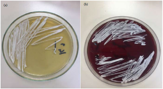 Image for - First Documented Mastitis Case of Nocardia puris in Turkey from Two Cows: Microbiological and Molecular Identification