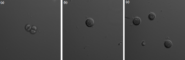 Image for - Lipid Droplet Synthesis in Chlorococcopsis minuta Mediated by Nitrogen Deprivation for Higher Lipid Productivity