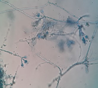penicillium notatum microscope