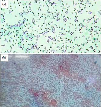 Image for - Beta-lactamases and Virulence Factors Characterization in Gram-negative Bacterial Species Isolated from Diabetic Foot Ulcer Patients