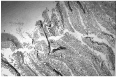 Image for - Histopathology of the Infestation of Parasitic Isopod Joryma tartoor of the Host Fish Parastromateus niger
