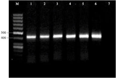 Image for - Evaluation of Modified Novy-MacNeal-Nicolle Medium for Isolation of Leishmania Parasites from Cutaneous Lesions of Patients in Iran