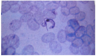 Image for - An Outbreak of Trypanosomiasis (Surra) in Camels in the Southern Fars Province of Iran: Clinical, Hematological and Pathological Findings