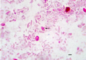 Image for - Detection of Microsporidian Spores in Faeces of Pigs of Farms of Nuevo Leon, Mexico