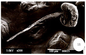 Image for - Description of Eggs and Larval Stages of Fasciola, Light and Scanning  Electron Microscopic Studies