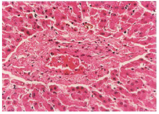 Image for - Clinico-Pathologic Evaluation of the Canine Heartworm Infestation