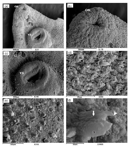 Image for - Scanning Electron Microscopic Observations of Adult Fasciola gigantica  after Immunization with Glutathione S-Transferase in Goats
