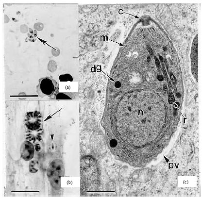 Image for - Toxoplasma gondii Strategy for Intracellular Survival: Is it Still Enigmatic?