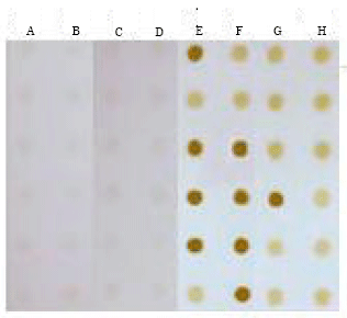Image for - Efficacy of Sandwich and Dot-ELISA in Diagnosis of Fascioliasis using a Pair of Polyclonal Antibodies Against Cathepsin L Antigen in Naturally Infected Sheep