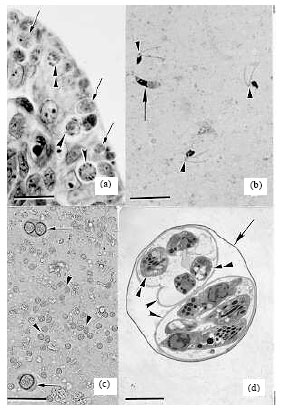 Image for - Toxoplasma gondii Strategy for Intracellular Survival: Is it Still Enigmatic?