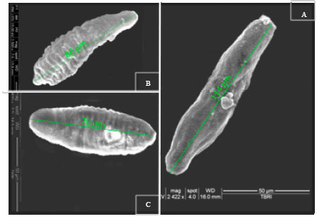 Image for - In vitro Anti-schistosomal Activity of "Plectranthus tenuiflorus" on Miracidium, Cercaria and Schistosomula Stages of Schistosoma mansoni
