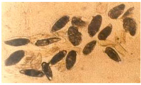 Image for - Parasitological Changes Within Experimentally Murine Schistosomiasis Mansoni upon Treatment by Somatostatin, Artemether and Their Combination