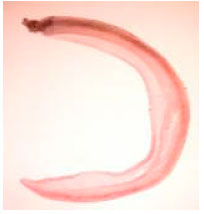 Image for - Parasitological Changes Within Experimentally Murine Schistosomiasis Mansoni upon Treatment by Somatostatin, Artemether and Their Combination