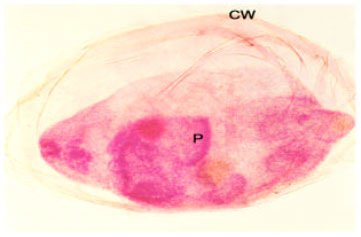 Image for - Histopathology of Heart of Freshwater Spiny Eel, Mastacembelus armatus Naturally Infected with Tetracotyle Metacercaria (Trematoda: Strigeidae)