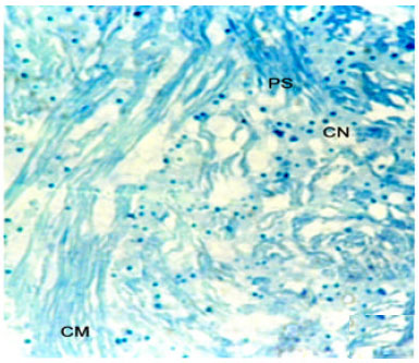 Image for - Histopathology of Heart of Freshwater Spiny Eel, Mastacembelus armatus Naturally Infected with Tetracotyle Metacercaria (Trematoda: Strigeidae)