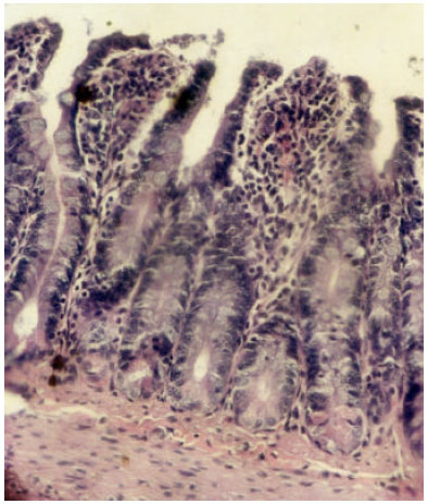Image for - Role of COX-2 in Pathogenesis of Intestinal Cryptosporidiosis and Effect of some Drugs on Treatment of Infection