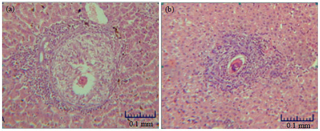 Image for - Susceptibility of Hedgehog, Hemiechinus auritus to Schistosoma 
  mansoni under Experimental Infection