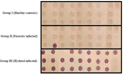 Image for - Comparative Evaluation of Different Diagnostic Techniques using Laminated  Layer Antigen for Serodiagnosis of Human Hydatidosis
