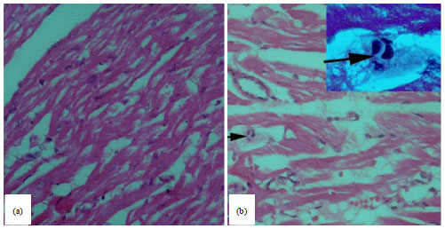 Image for - Detection of Toxoplasma gondii (Apicomplexa: Sarcocystidae) in the Brown Dog Tick Rhipicephalus sanguineus (Acari: Ixodidae) Fed on Infected Rabbits