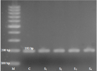 Image for - Comparison of PCR and Serologic Survey for Diagnosis of Toxoplasmosis in Sheep