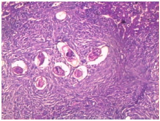Image for - Role of Toll Like Receptors 4, 5 and 9 Ligands in Pathogenesis and Outcome of Intestinal and Hepatic Schistosomiaisis Caused by Schistosoma mansoni