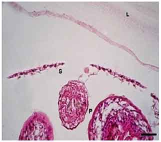 Image for - Administration of Zataria multiflora as a Novel Therapeutic Strategy in Destruction of the Germinal Layer of Hydatid Cyst