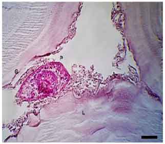 Image for - Administration of Zataria multiflora as a Novel Therapeutic Strategy in Destruction of the Germinal Layer of Hydatid Cyst