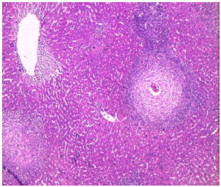 Image for - Role of Toll Like Receptors 4, 5 and 9 Ligands in Pathogenesis and Outcome of Intestinal and Hepatic Schistosomiaisis Caused by Schistosoma mansoni