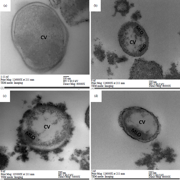 Image for - In Vitro and In Vivo Anti-blastocystis Efficacy of Olive Leaf Extract and Bee Pollen Compound