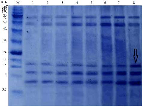 Image for - Comparative Serodiagnostic Evaluation of Tegumental Antigenand its 16.5 KDa Subunit to Crude Antigens in Human Fascioliasis