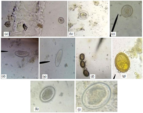 Image for - Mini-FLOTAC Versus Other Copromicroscopic Methods in Diagnosis of Intestinal Parasitic Infections