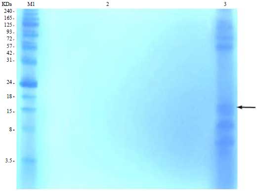 Image for - Comparative Serodiagnostic Evaluation of Tegumental Antigenand its 16.5 KDa Subunit to Crude Antigens in Human Fascioliasis