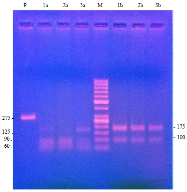 Image for - Monotypic PCR-RFLP Pattern of Circulating Theileria annulata Isolates from North India Based on HSP 70 gene