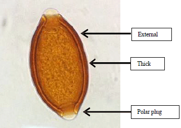 Image for - Additional Egg Disruption Techniques Facilitate Better DNA Yield for Species Level Identification of Ascaris lumbricoides and Trichuris trichiura