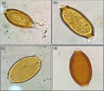 Image for - Additional Egg Disruption Techniques Facilitate Better DNA Yield for Species Level Identification of Ascaris lumbricoides and Trichuris trichiura