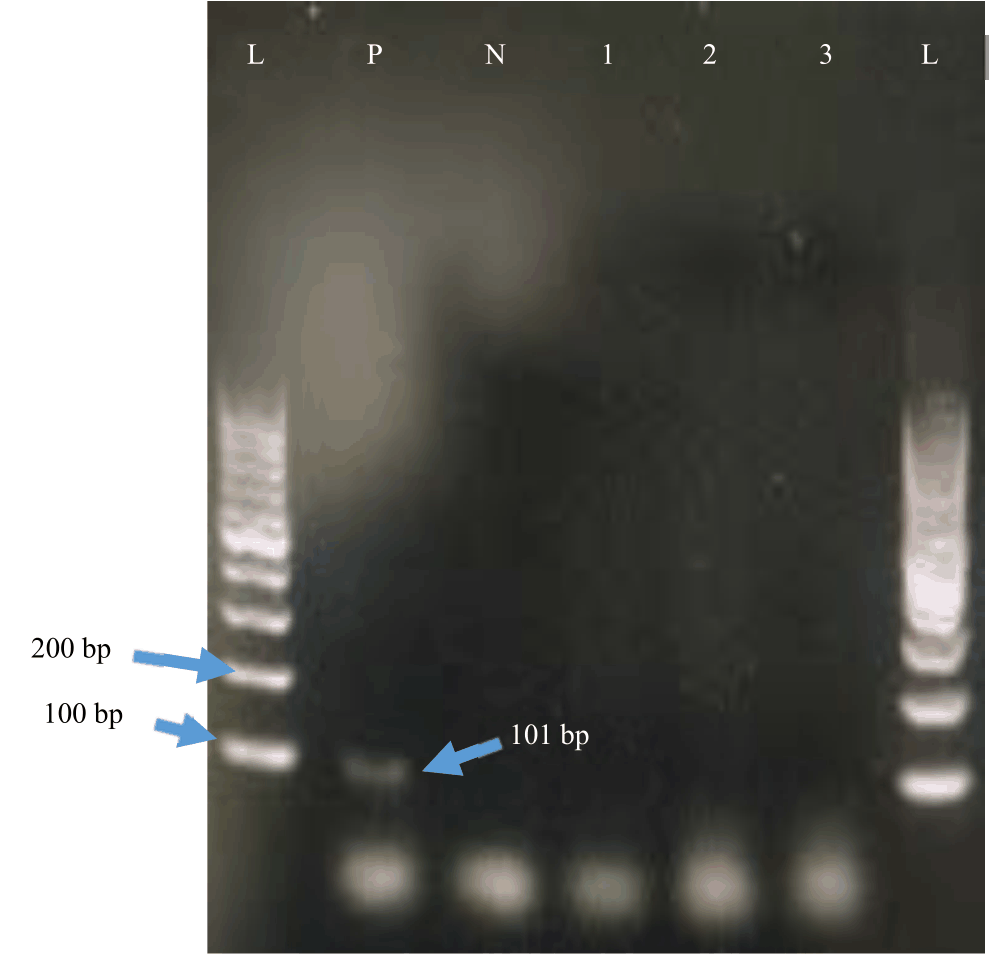 Image for - Simultaneous Detection of Ascaris lumbricoides, Trichuris trichiura and Strongyloides stercoralis using Modified Stool DNA Extraction Method