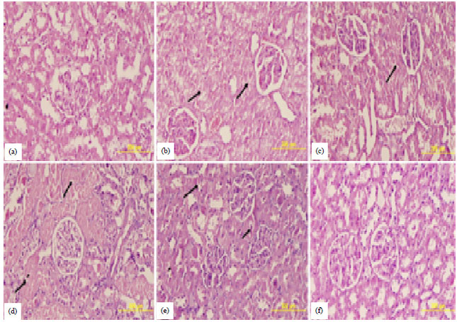 Image for - Combination of Tribulus terrestris, Boerhaavia diffusa and Terminalia chebula Reverses Cisplatin-induced Nephrotoxicity in Wistar Rats